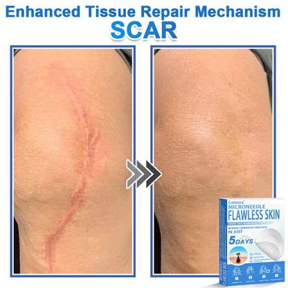 2-in-1 Microneedle & Hydrocolloid Patch | Raised Moles,Acne,  Flat Warts & Skin Tags Remover | Improves Wrinkles, Scars & Blemishes | Invisible Star Pimple Patches for Face & Body