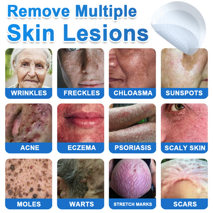 2-in-1 Microneedle & Hydrocolloid Patch | Raised Moles,Acne,  Flat Warts & Skin Tags Remover | Improves Wrinkles, Scars & Blemishes | Invisible Star Pimple Patches for Face & Body