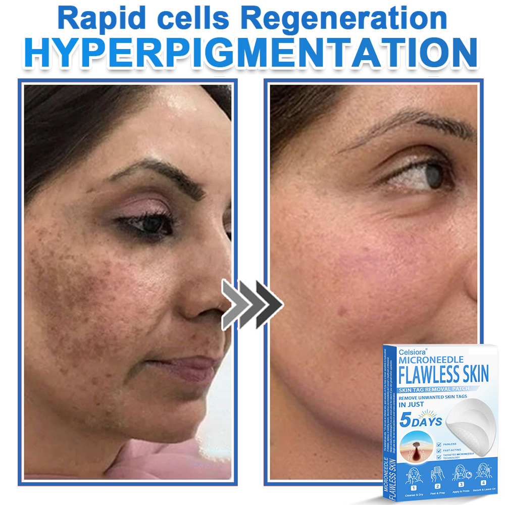 2-in-1 Microneedle & Hydrocolloid Patch | Raised Moles,Acne,  Flat Warts & Skin Tags Remover | Improves Wrinkles, Scars & Blemishes | Invisible Star Pimple Patches for Face & Body